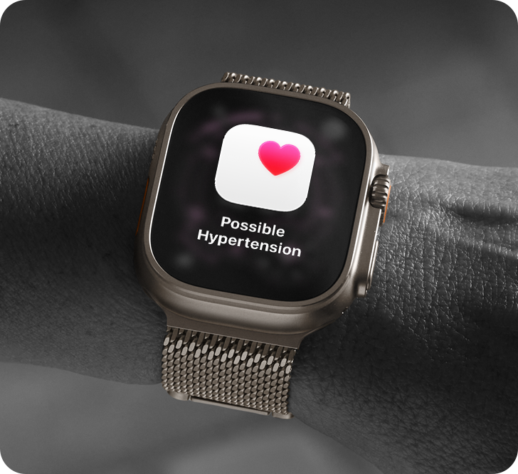Apple Watch Ultra 2 thumbnail 5